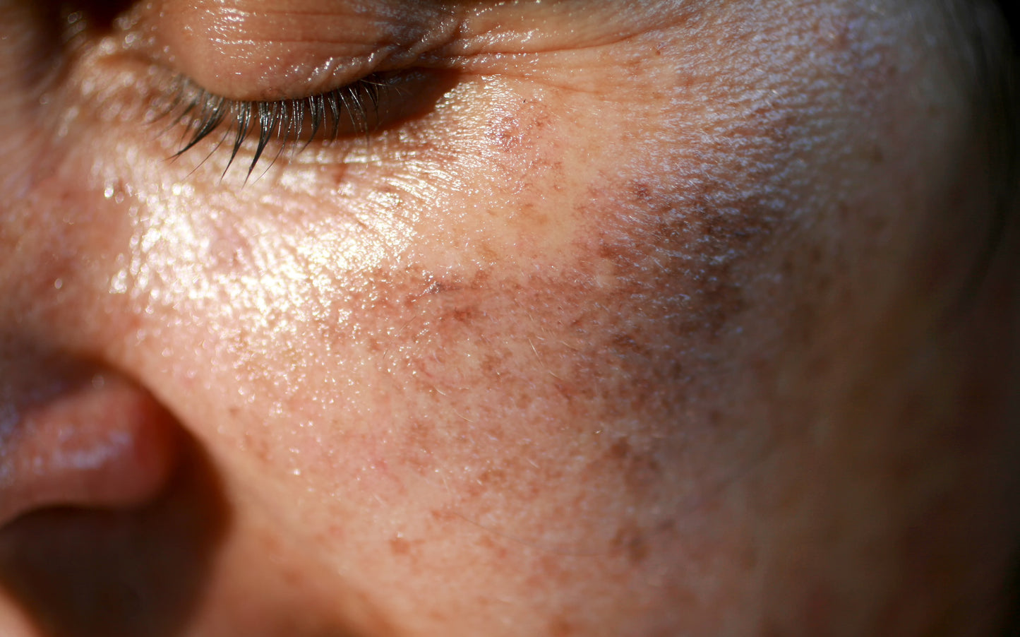 Kit anti macchia "Perfezione Mediterranea"