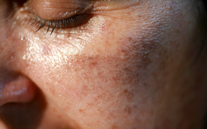 Kit anti macchia "Perfezione Mediterranea"